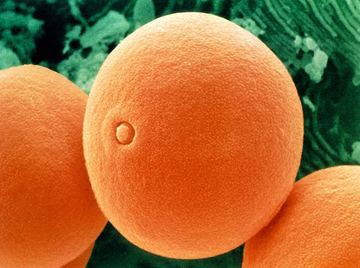 Pollen Grains Under Microscope Amusing